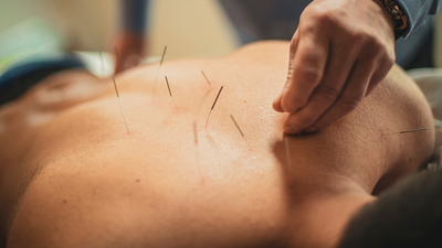 Acupuncture pour soulager les symptômes des règles et du syndrome prémenstruel (SPM) : une approche naturelle et efficace